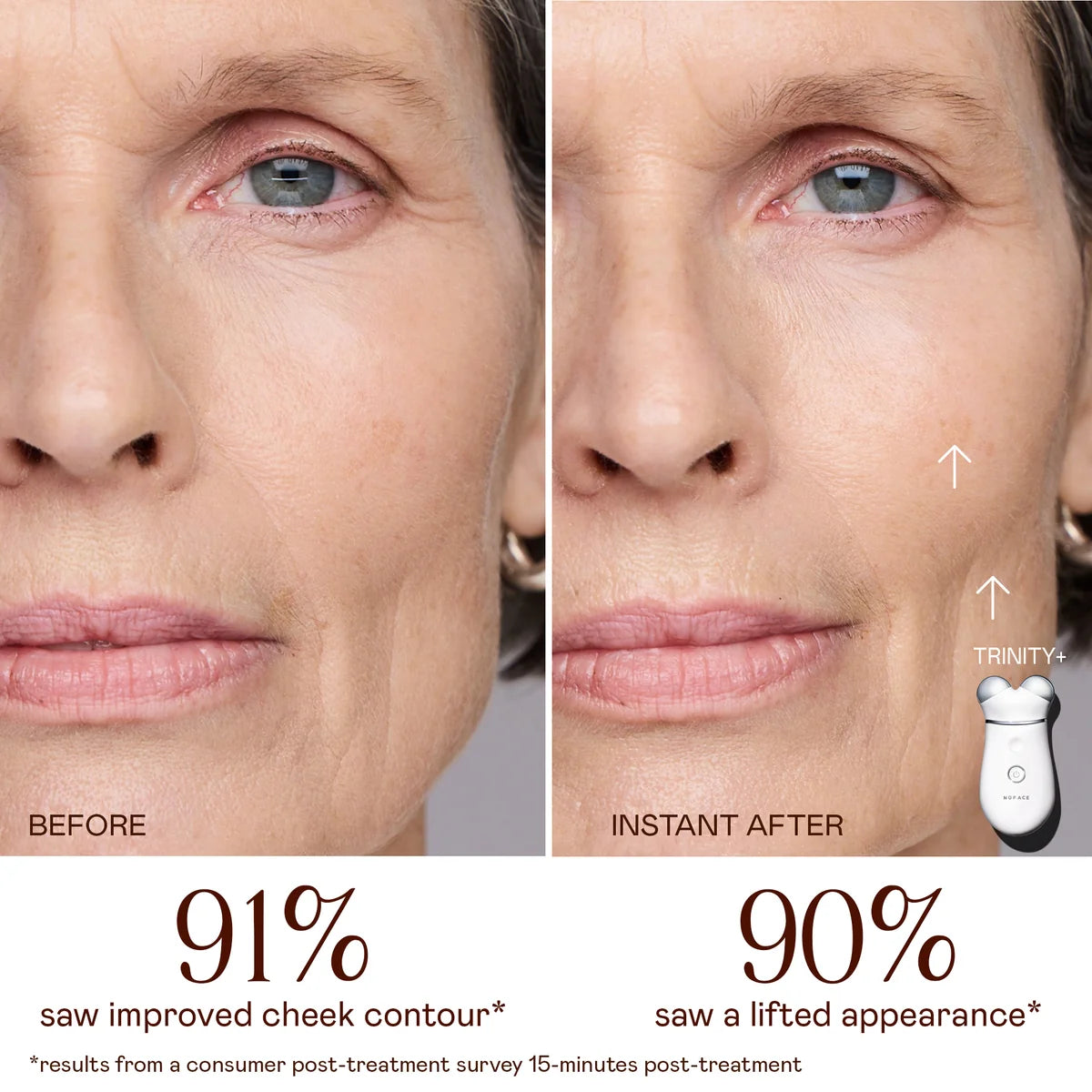 NuFace Trinity + PRO with ELE (Effective Eye + Lip Attachment)