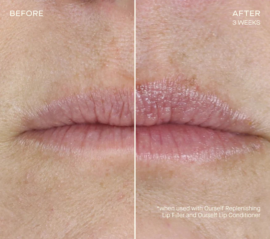 Ourself Replenishing Lip Filler with Tiered-Release Vesicle Delivery Technology™