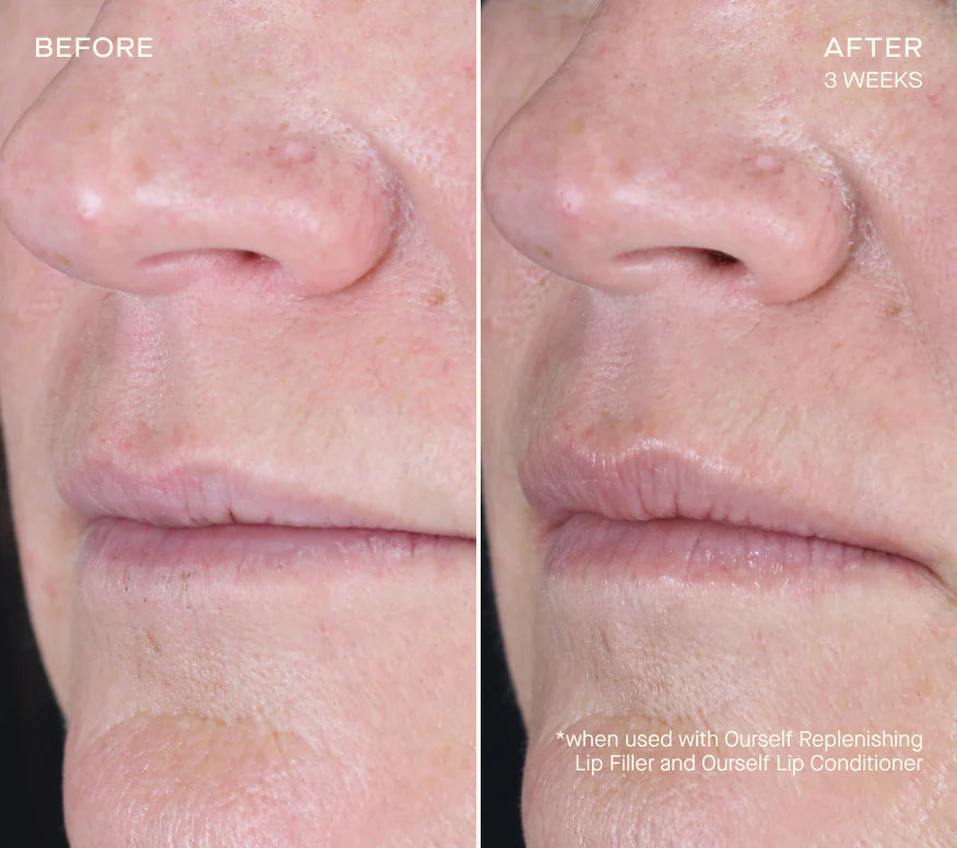 Ourself Replenishing Lip Filler with Tiered-Release Vesicle Delivery Technology™