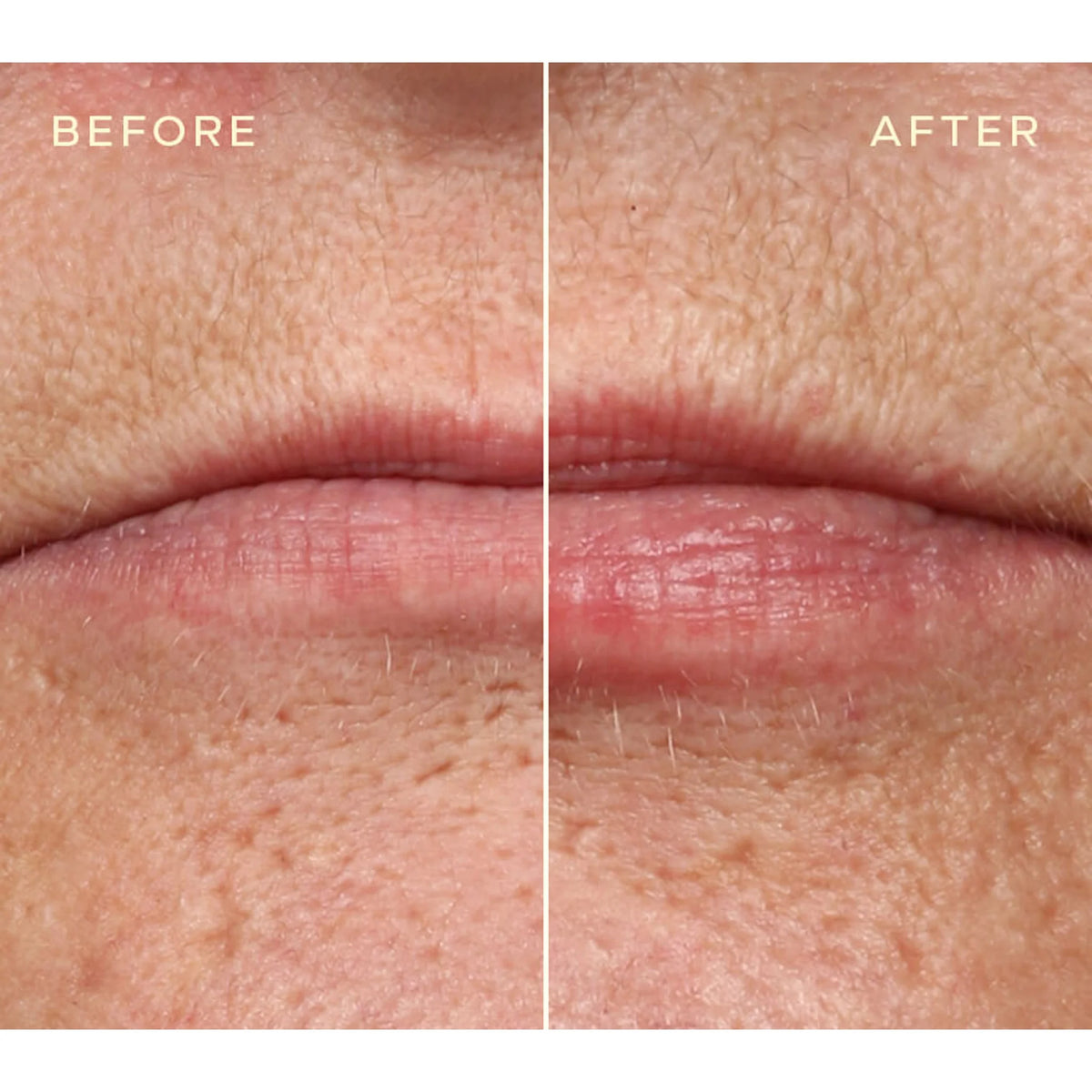 Ourself Replenishing Lip Filler Refill