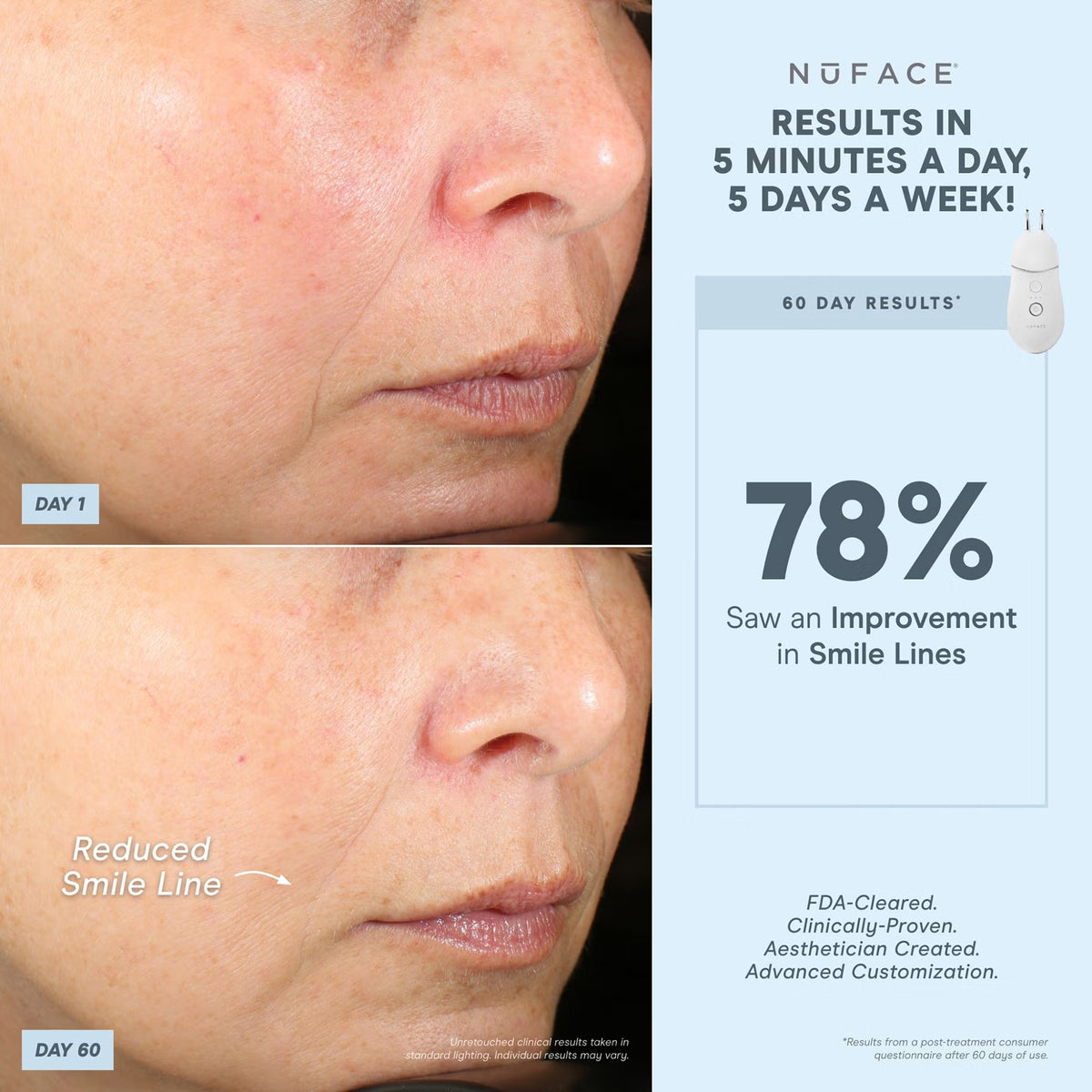 TRINITY+ Lifting & Smoothing Lip & Eye Microcurrent Attachment